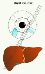 Liver right iris
