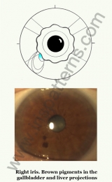 Iris brown pigments