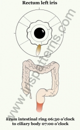 Left iris rectum