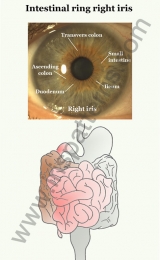 Intestinal ring right iris