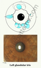 Left glandular iris