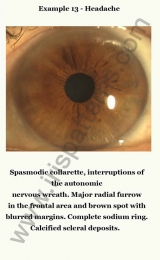 Headache: example #1
