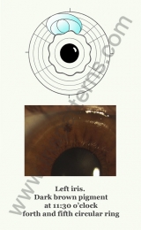 Encephalon left iris