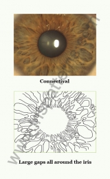 Connectival iris