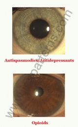 Antispasmodics/Opioids