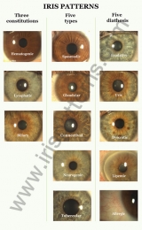Iris Patterns